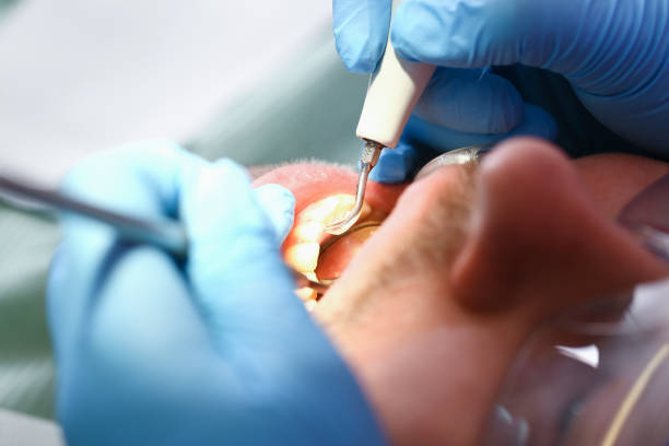 Best Broken or Cracked Tooth Emergency Dentist in Bevil Oaks, TX