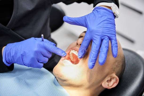 Best Emergency Dental Care for Abscessed Tooth in Bevil Oaks, TX